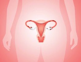 Endometriosis - illustration